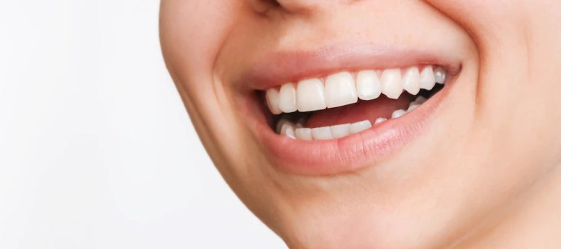 Close-up of a restored smile with full ceramic crowns