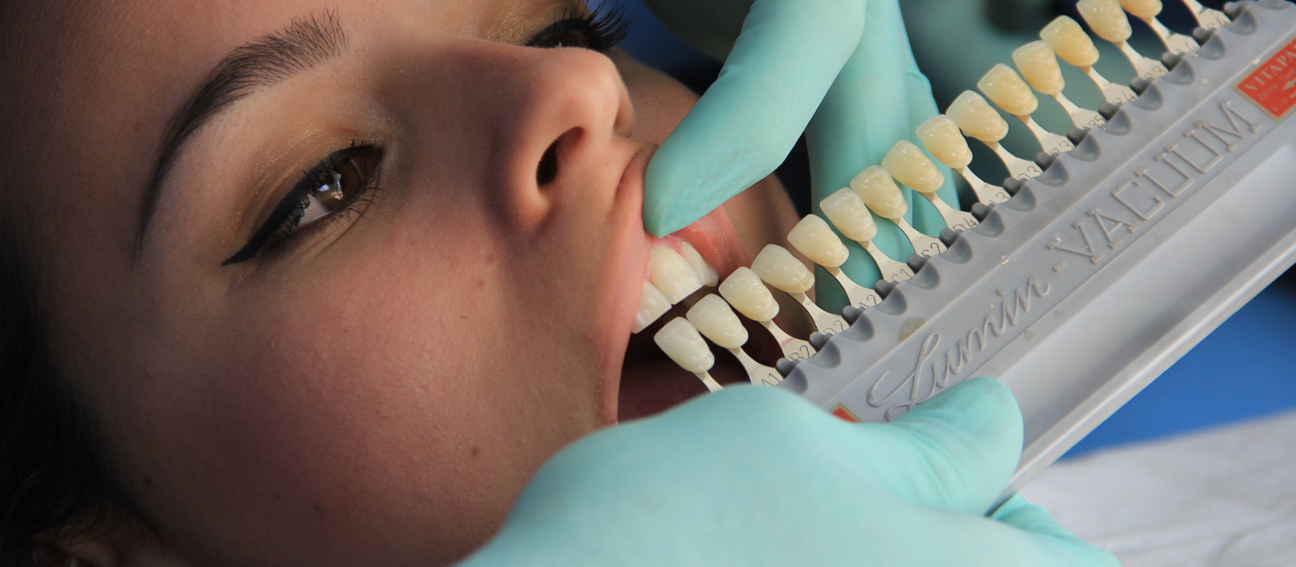 Dentist matching a porcelain shade guide to a patient's teeth in natural light