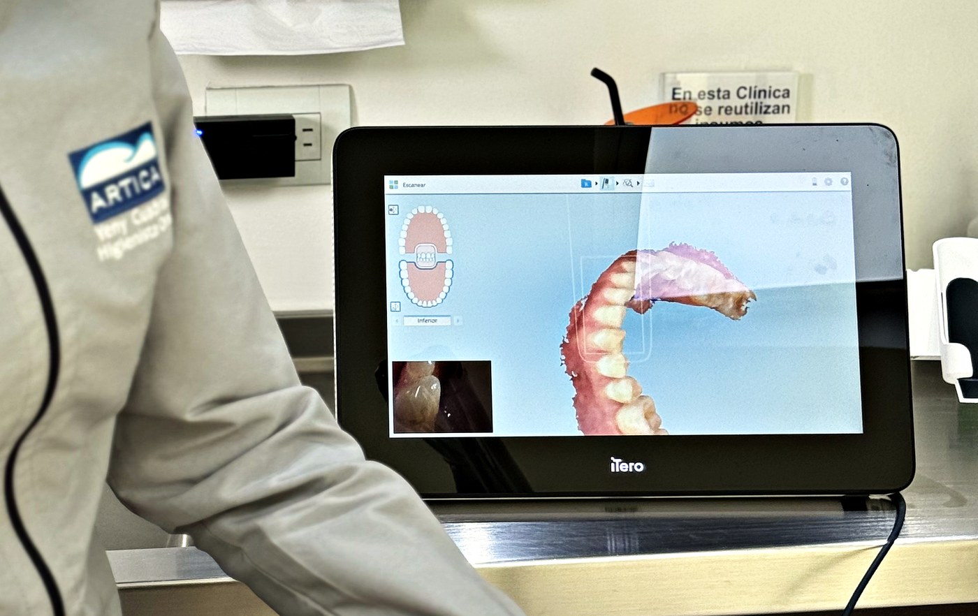 An iTero intraoral scanner in use at Medellin Dental Solutions in El Poblado, Medellín