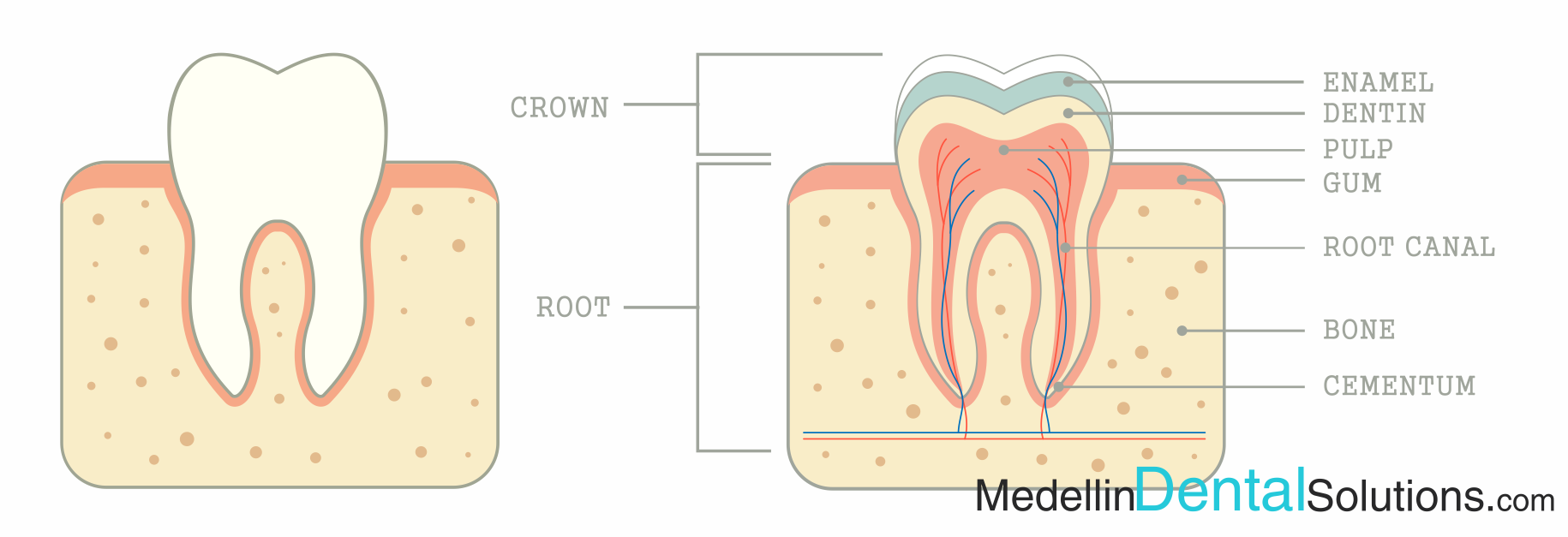Cross-section of a tooth showing the enamel, dentin, pulp and root canals, for root canals treatment in Medellín